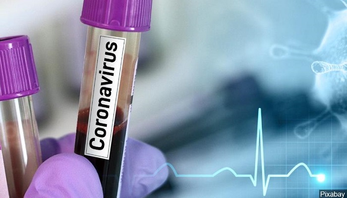 The country's total number of coronavirus cases stands at 34,259