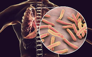 The spread of Tuberculosis is increasing in men